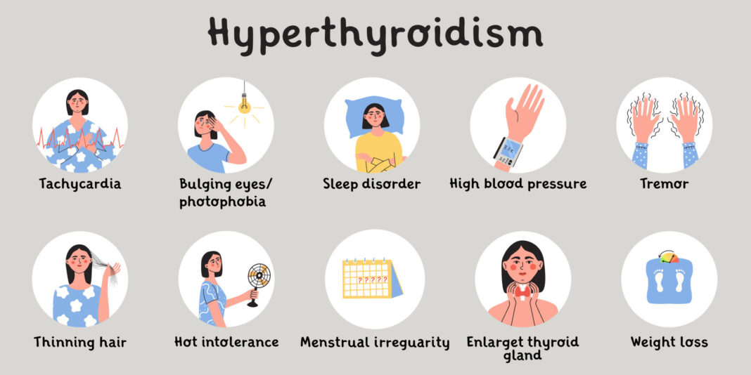 hyperthyroidism-symptoms-an-ultimate-guide this blog is very informative relevent to health about hyperthyroidism symptoms.